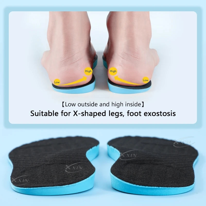 【Xxin】Men Women X leg Correction Insoles Orthopedic Shoe Pads O leg Insole Flat Arch Shoe Inserts Size 35-46
