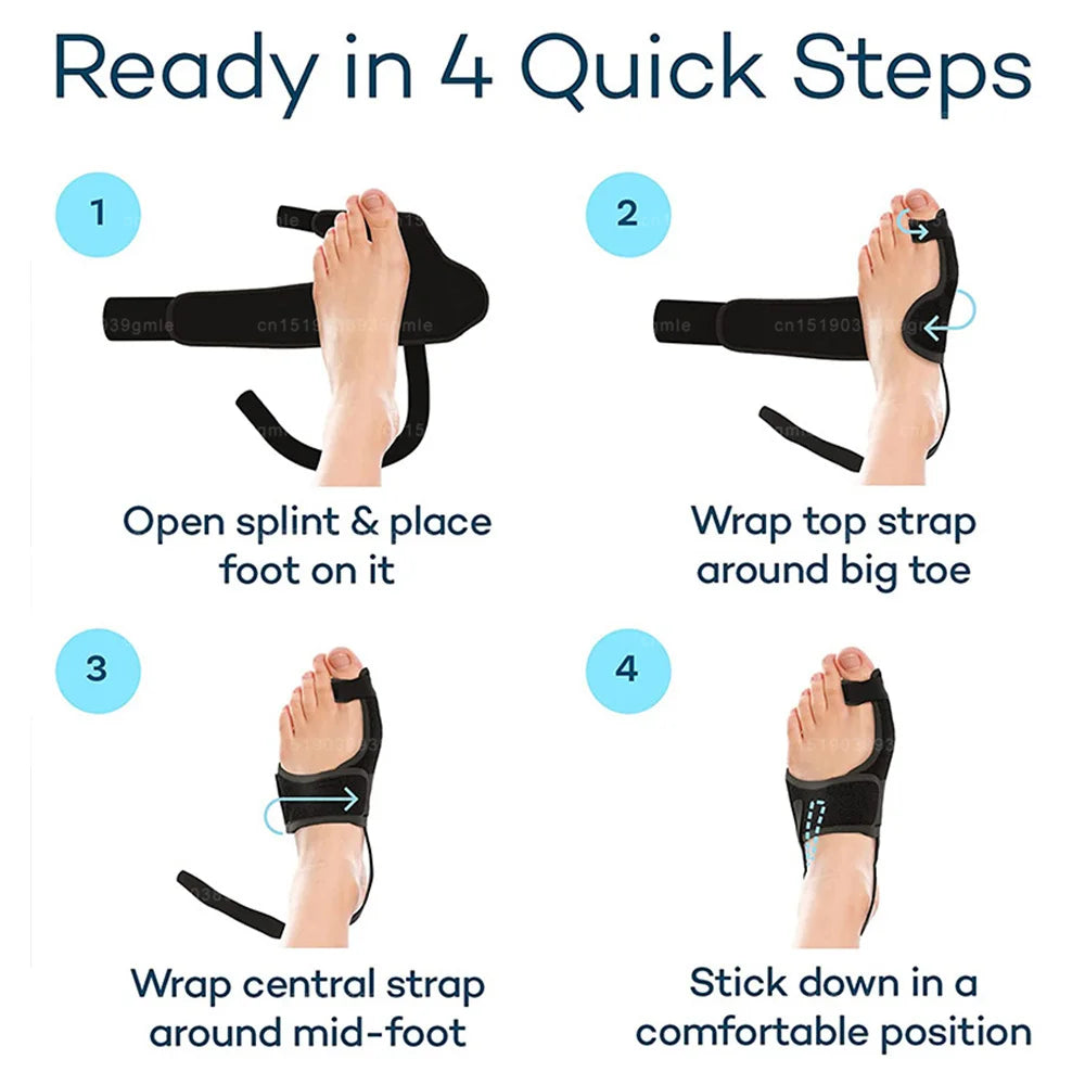 Toe Correction Hallux Valgus Corrector Straightening Big Toe Orthotics Stainless Steel Support Strap Feet Separator Bunion