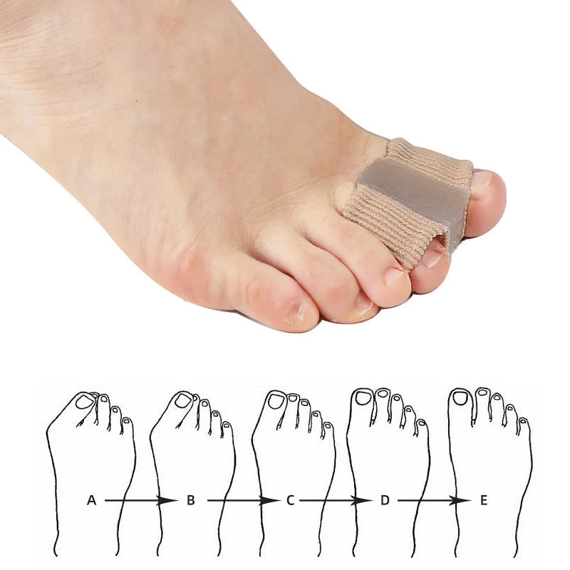 Toe Separator Silicone Pedicure Tools Bones Orthopedics Bunion Corrector Gel Insoles For Shoes (1/2/4pcs)