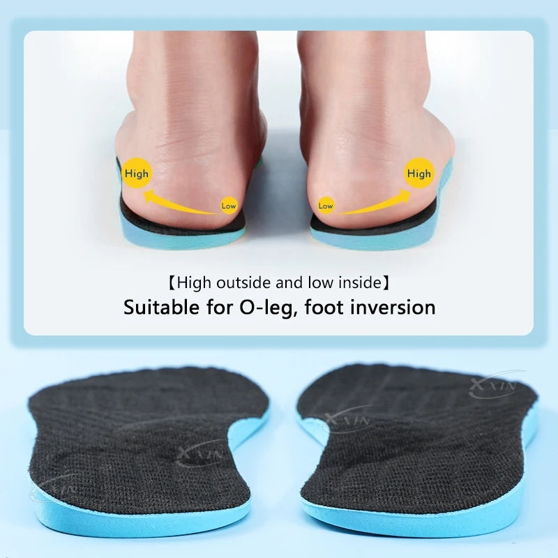 【Xxin】Men Women X leg Correction Insoles Orthopedic Shoe Pads O leg Insole Flat Arch Shoe Inserts Size 35-46