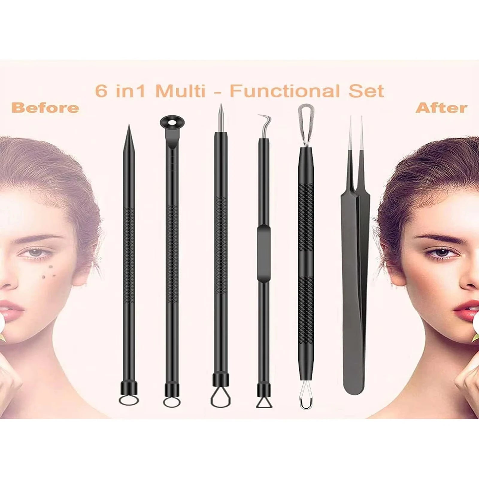 6pcs/set Acne Removal Needle and Clip Stainless Steel Tool Blackhead Removal Blemishes Facial Skin Care Beauty Facial Pore Clean - FitHealthHavenFitHealthHavenFitHealthHaven14:1936PC-Black6PC-Black6pcs/set Acne Removal Needle and Clip Stainless Steel Tool Blackhead Removal Blemishes Facial Skin Care Beauty Facial Pore Clean