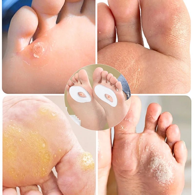 6pcs/sheet Foot Callus Pain Heel Stickers Felt Corns Self-adhesive Sticker Preventing Calluses Pain Abrasion Protective Patches - FitHealthHavenFitHealthHavenFitHealthHaven14:771circular-1 sheet;200007763:201336100circular-1 sheetCHINA6pcs/sheet Foot Callus Pain Heel Stickers Felt Corns Self-adhesive Sticker Preventing Calluses Pain Abrasion Protective Patches