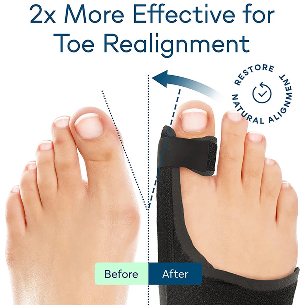 Toe Correction Hallux Valgus Corrector Straightening Big Toe Orthotics Stainless Steel Support Strap Feet Separator Bunion