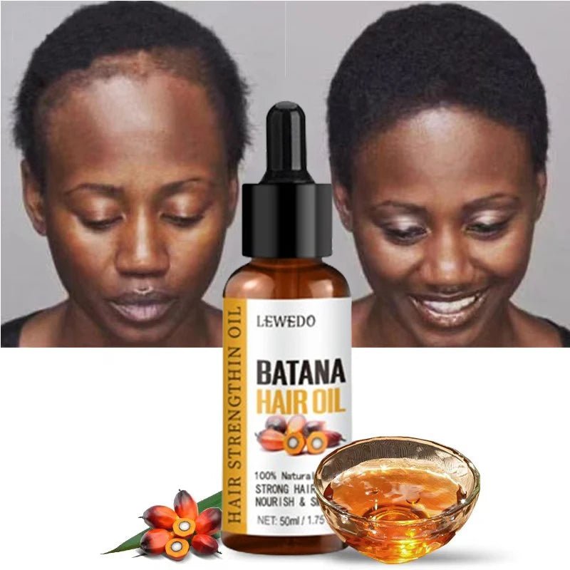 Lewedo Naturals Batana Oil Fast Hair Growth for Men Women Pure Batana Oil Nourish Shiny Hair Healthy Hair Care Anti Hair Loss - FitHealthHavenFitHealthHavenFitHealthHaven14:2000048913pcs batana oil3pcs batana oilLewedo Naturals Batana Oil Fast Hair Growth for Men Women Pure Batana Oil Nourish Shiny Hair Healthy Hair Care Anti Hair Loss