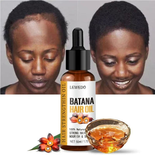 Lewedo Naturals Batana Oil Fast Hair Growth for Men Women Pure Batana Oil Nourish Shiny Hair Healthy Hair Care Anti Hair Loss - FitHealthHavenFitHealthHavenFitHealthHaven14:2000048913pcs batana oil3pcs batana oilLewedo Naturals Batana Oil Fast Hair Growth for Men Women Pure Batana Oil Nourish Shiny Hair Healthy Hair Care Anti Hair Loss